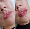 .Сертифицированный врач-косметолог.